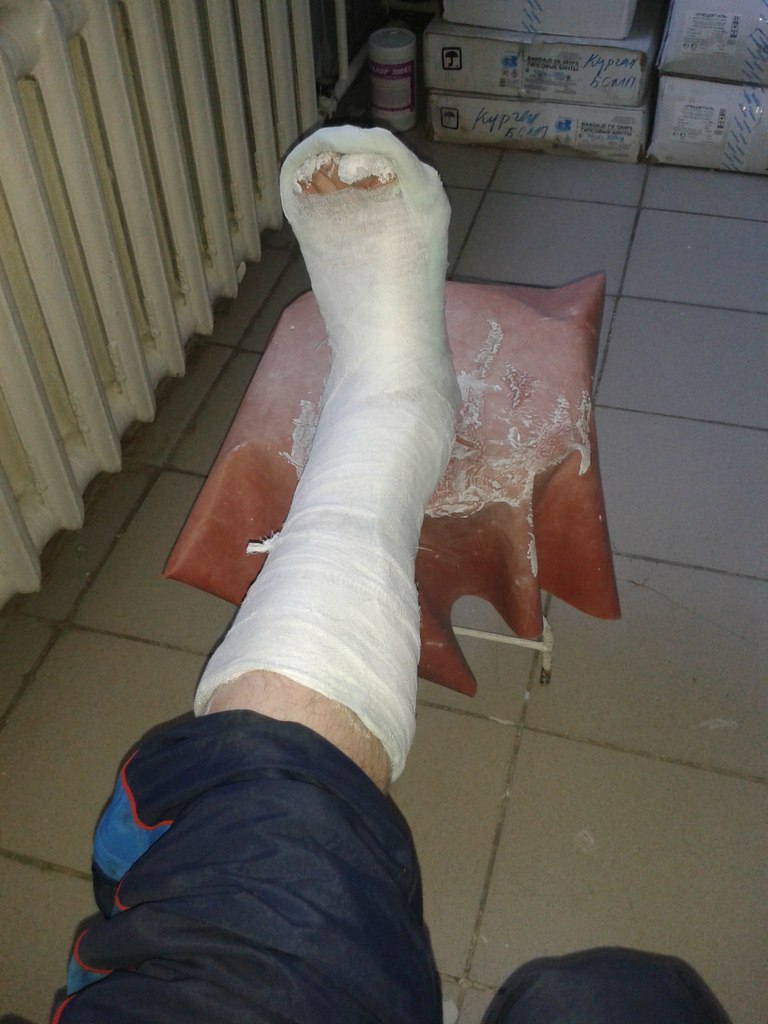 При переломе нога потемнела